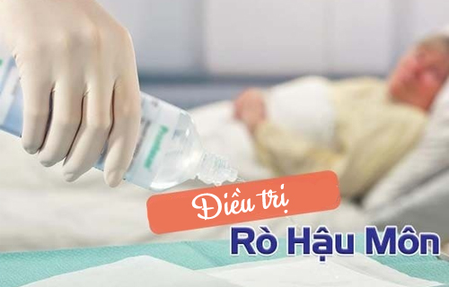 Rò hậu môn nhẹ có thể điều trị bằng thuốc