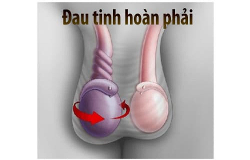 Đau tinh hoàn - Dấu hiệu bệnh lý nam khoa nguy hiểm